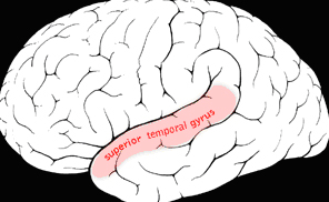 Picture of brain highlighting the superior temporal gyrus